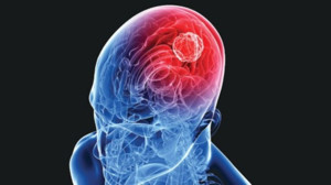 BAÜN Akademisyenleri Keşfetti: Türkiye’de İlk, Dünya'da 31. Vaka