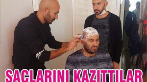 SAÇLARINI KAZITTILAR