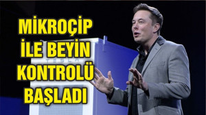 Elon Musk mikroçip ile beyin kontrolünün başarıldığını duyurdu