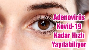Adenovirüs Kovid-19 Kadar Hızlı Yayılabiliyor