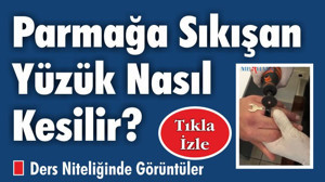 Parmağa Sıkışan Yüzük Nasıl Kesilir?