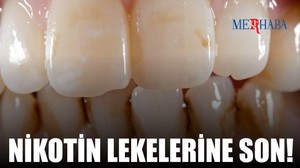 Nikotin Lekelerine Son!