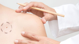 5 Yaygın Kanser Belirtisi