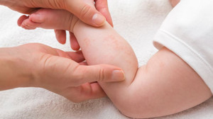 Bebeklerinizde Pişik Oluşumunu Engelleyin