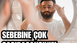 Neden Erkeklerin Cildi Daha Güzel?