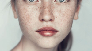 Güneş Lekelerine Karşı Doğal Yöntemler