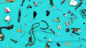 Şiddetli Karın Ağrısı: Midesinden Neler Neler Çıktı !