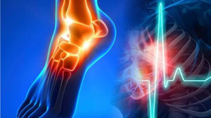 Ayak Bileklerinde Şişme Ölümle Sonuçlanabiliyor!