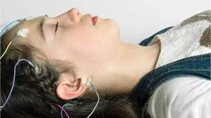 Epilepsi Hakkında Doğru Bilinen Yanlışlar