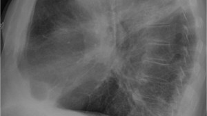 BAÜN Önemli Sağlık Çalışmasını Yayınlandı