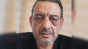 BURHANİYE’Lİ GAZETECİ SALDIRIYA UĞRADI