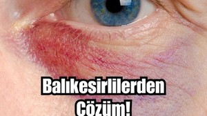 Gözaltı Morluklarına Balıkesirli Kadınların Sırrı