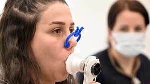 ALO 171 Sigara Bırakma Hattı, 2024'te 308 Bin Kişiye Destek Sağladı