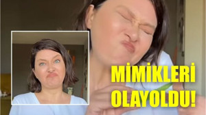 Akıma Nurgül Yeşilçay da Katıldı! Yüzü Şekilden Şekile Girdi