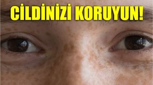 Güneş Lekelerini 5 Adımda Önleyin