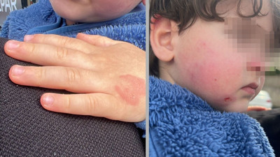 Kreşte Şok Olay! 2,5 Yaşındaki Çocuğa Darp İddiası