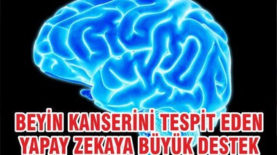 Beyin Kanserini Tespit Eden Yapay Zekaya Büyük Destek
