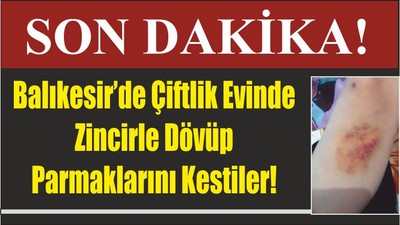 Balıkesir’de Çiftlik Evinde Zincirle Dövüp Parmaklarını Kestiler!