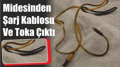 Midesinden Şarj Kablosu Ve Toka Çıktı
