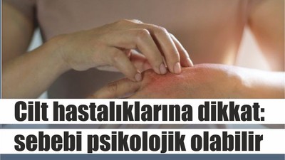 Cilt hastalıklarına dikkat: sebebi psikolojik olabilir