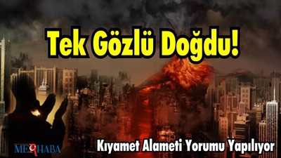 Tek Gözlü Doğdu! Kıyamet Alameti Yorumu Yapılıyor