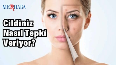 Cildimizin Olaylara Verdiği Reaksiyon