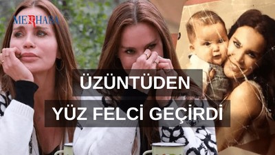 Üzüntüden Yüz Felci Geçirdi!