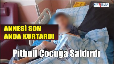 Pitbull Çocuğa Saldırdı