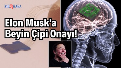 Musk'a Beyin Çipi Onayı!
