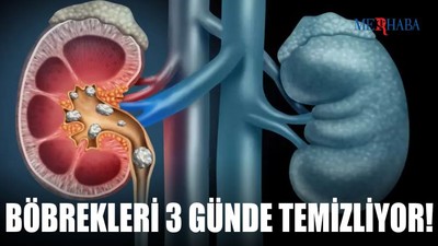 Böbrekleri 3 Günde Temizliyor!