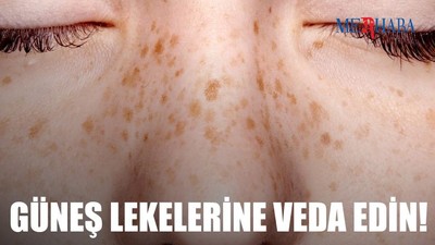 Güneş Lekelerine Veda Edin