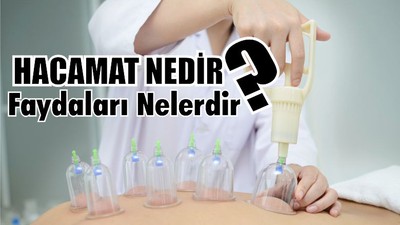 Hacamat Faydaları Nedir?