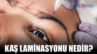 Kaş Laminasyonu Nedir?