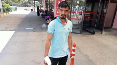 Kasap Makineye parmağını kaptırdı