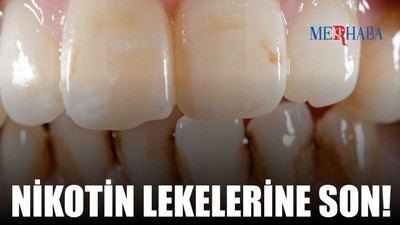Nikotin Lekelerine Son!