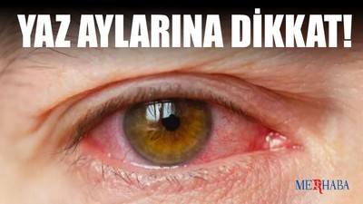 Yaz Aylarında Gözlere Dikkat!