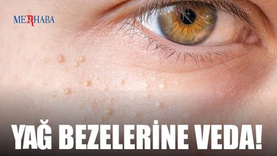 Yüzdeki Yağ Bezelerine Veda!