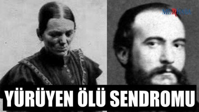 Yürüyen Ölü Sendromu