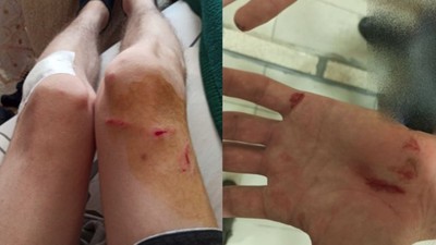 Dehşet Dolu Anlar: Kadınlar Saldırıya Maruz Kaldı