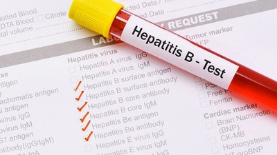 Hepatit Beklemez!