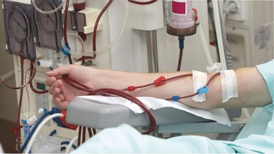 Ev hemodiyaliz hizmeti alınacak