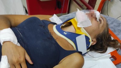 Balıkesir'de Korkunç Olay ! Scooterdan Düştü Ardından Köpekler Saldırdı