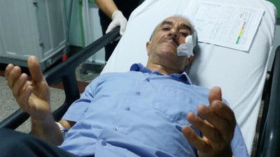 Maganda Kurşunuyla Yüzünden Vuruldu