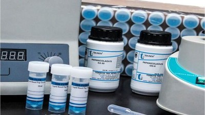 Sıvı bazlı sitoloji preparat hazırlama kiti alınacak