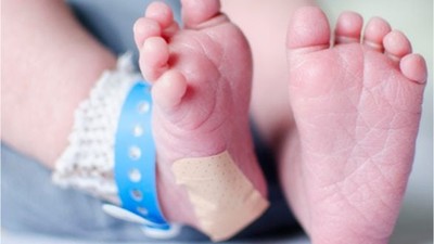 SMA Topuk Kanı Testi Zorunlu Mu?