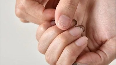 Tırnak Güçlendirmede Balıkesirliler 3 Yöntem Seçiyor