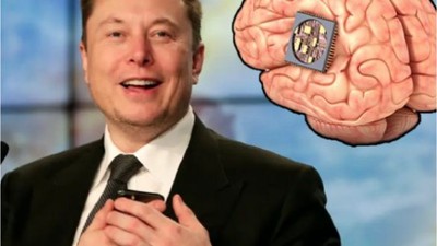 Musk: İlk Beyin Çipi İmplantı Başarıyla Gerçekleştirildi