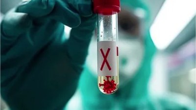 X Hastalığı: Bilinmeyen Bir Tehdit!