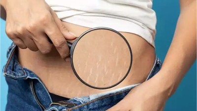Balıkesir’in Doğal Ürünleri ile Çatlak Bakımı