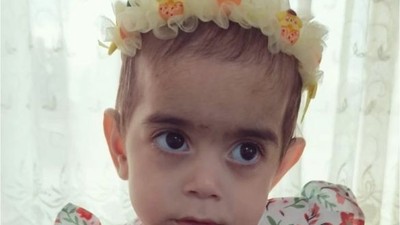 Bandırma'da Fevziye Bebek İçin Toplanan Yardımlar Sonuç Verdi